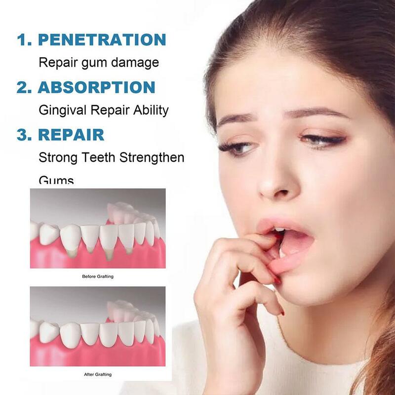 Gotas de reparación rápida de encías, suero para aliviar el dolor de dientes, las cavidades, blanquear los dientes, eliminar las manchas de placa amarilla, cuidado de los dientes, 30ml