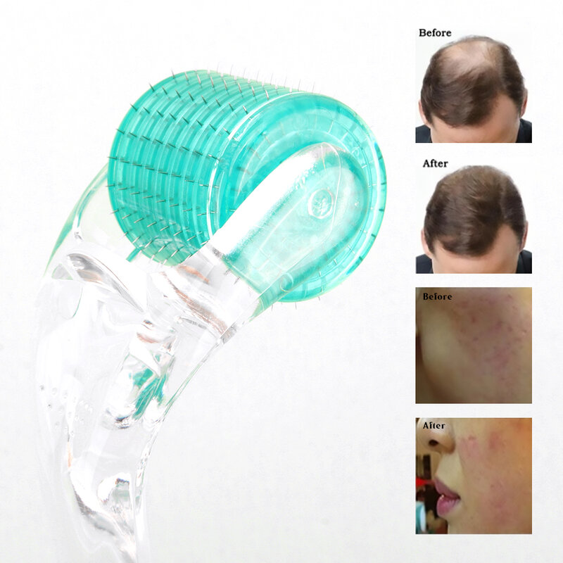 192 Real Needle Dermaroller Face Skin Care Derma Roller for Beard Scalp Hair Growth and Acne Scar MTS Microneedling Mesotherapy