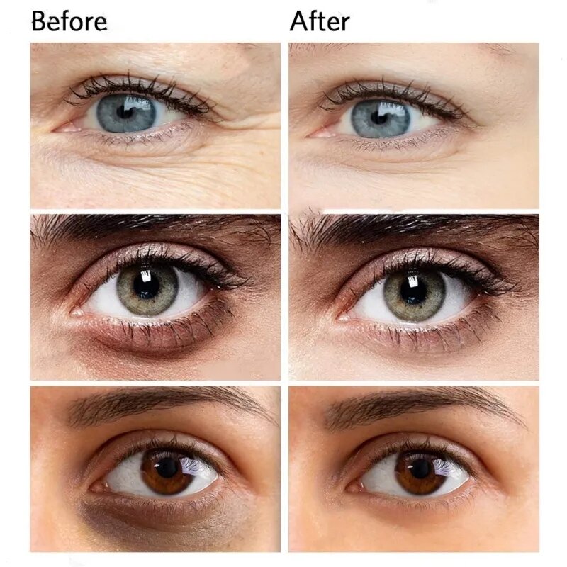 Augen pflege Anti-Falten-Augen creme Augenringe entfernen Augen taschen geschwollen reduzieren Falten feine Linien Augen fett partikel Gesichts pflege