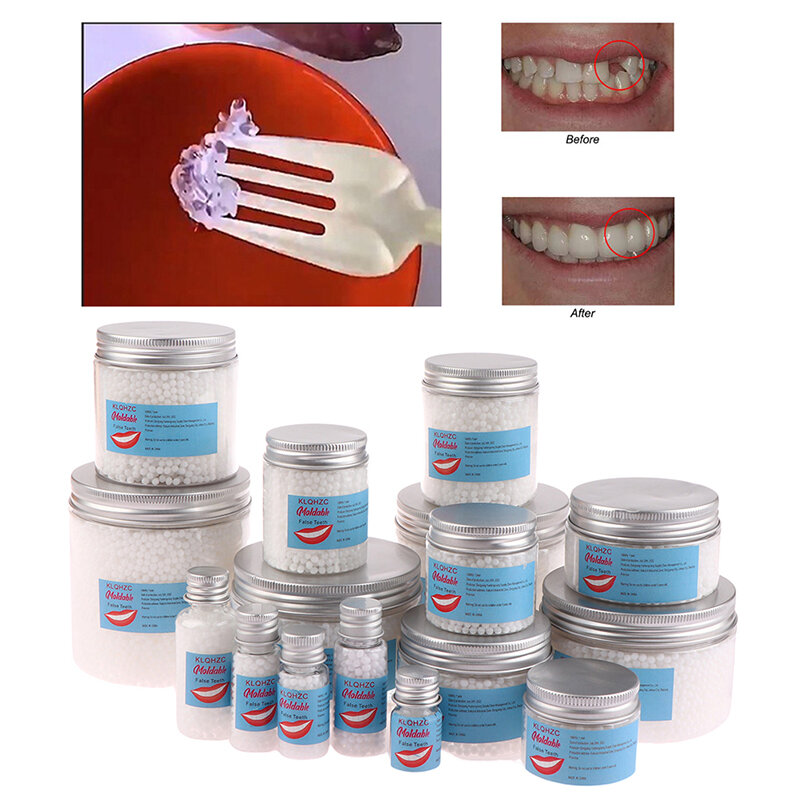 5-80ml resina colla per la riparazione dei denti fessure dei denti modellabili riempimento solido riparazione temporanea dei denti Falseteeth colla sicurezza forniture dentali