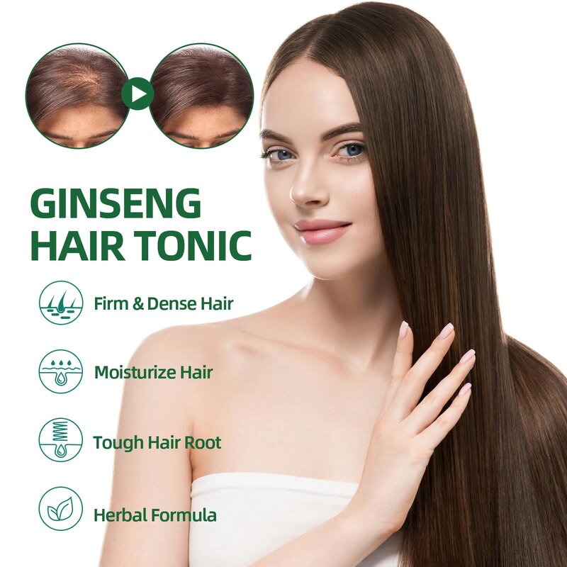 OUHOE-potente aceite para el crecimiento del cabello, productos para prevenir la caída del cabello, esencia Neo, extracto de Ginseng genuino, Spray para el crecimiento del cabello, anticaída