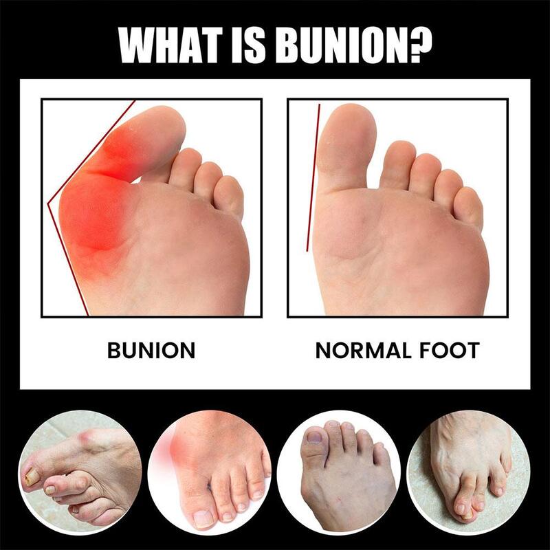 Anti-Bunions Health Sock Pain Stiffness Relief For Outdoor Sports Foot Care Socks Heels Warm Breathable Man Meias De Cuidad I7C0