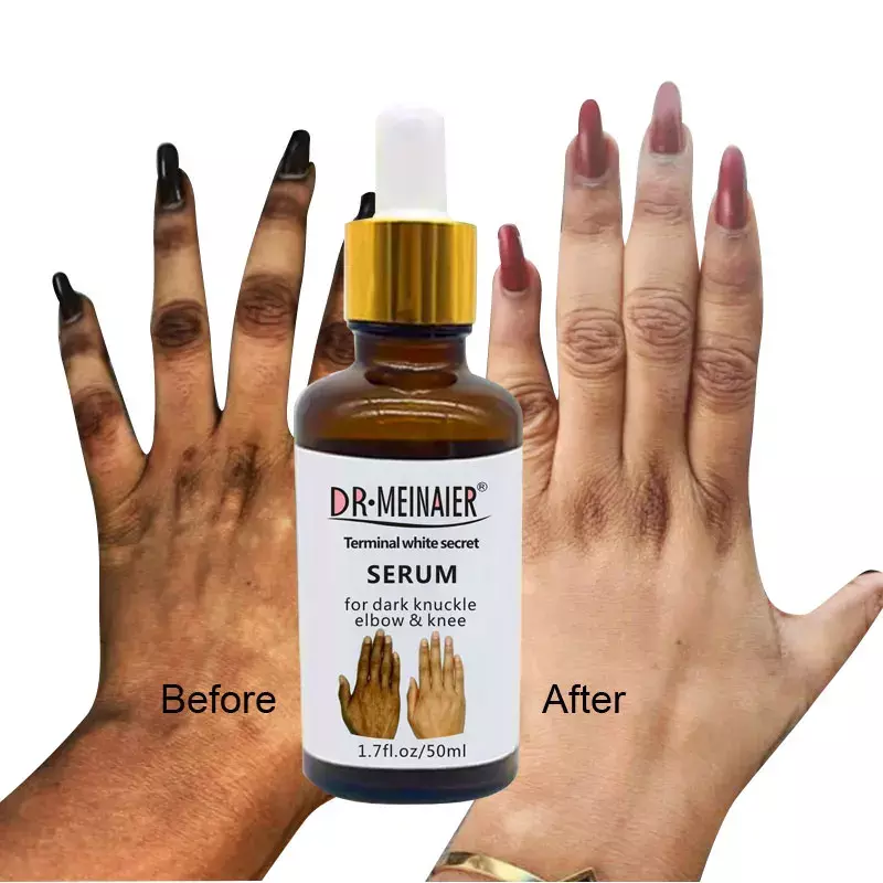 50ml Whitening Serum for Removing Dark Knuckle Elbow and Knee Strong Dark Knuckle