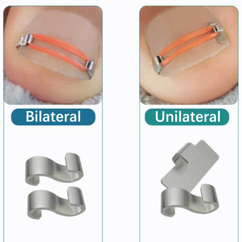 ペディキュア、埋め込み式つま先ネイルトリートメント用のingrown toenailは、プロのingrown toenail補正、フットケアツール