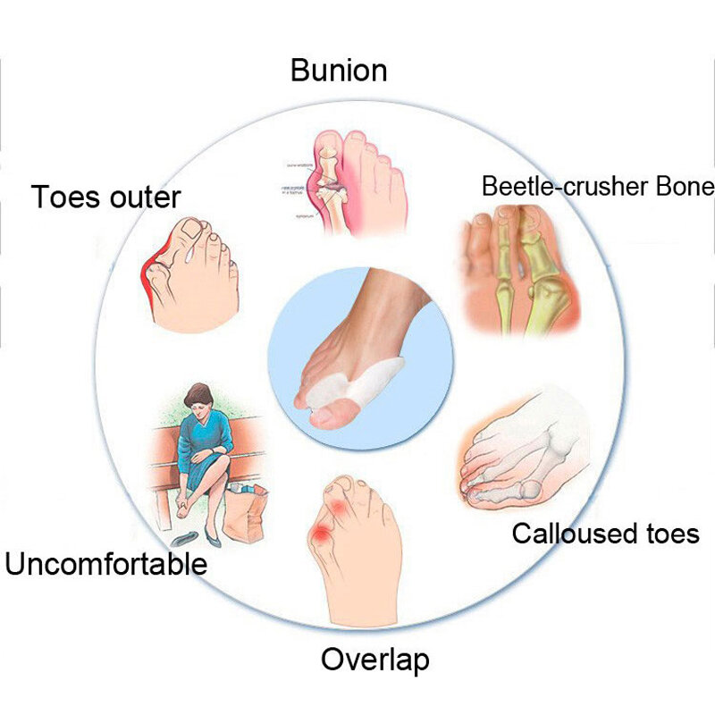 Silicone Gel Bunion Big Toe separador, Facilidade de Espalhador, Foot Pain Foot, Hallux Valgus correção, Guard Almofada, Corretivo, Polegar, 1 Par