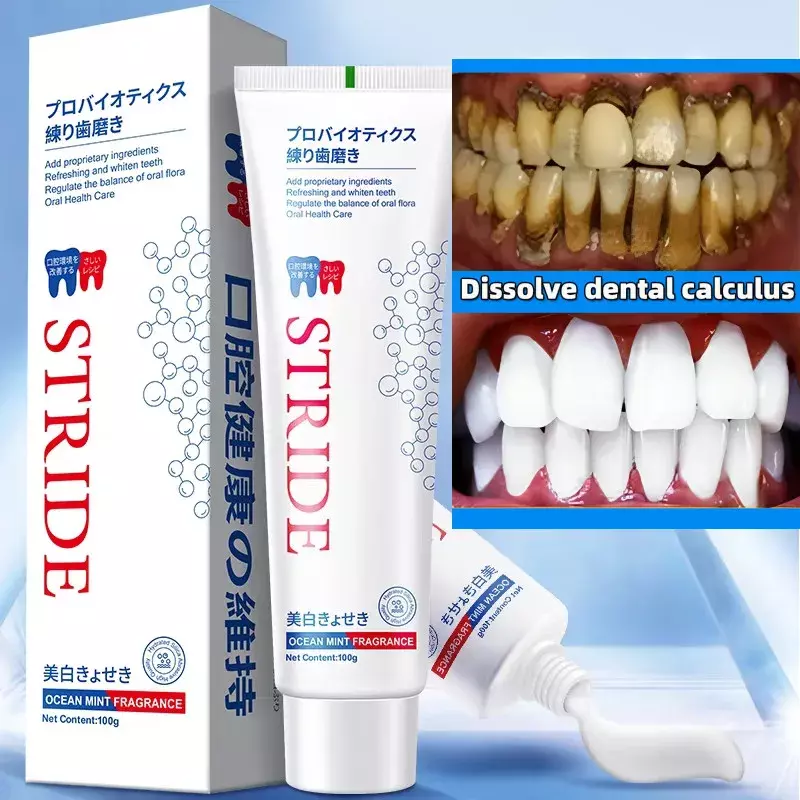 Rimozione del tartaro dentale sbiancamento dei denti rimozione del dentifricio alitosi prevenzione della parodontite sbiancamento dentale pulizia orale