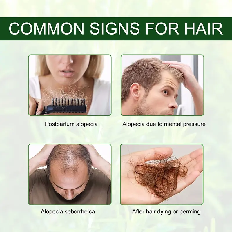 Aceite para el crecimiento rápido del cabello, reparación eficaz de la calvicie, pérdida posparto, seborreica