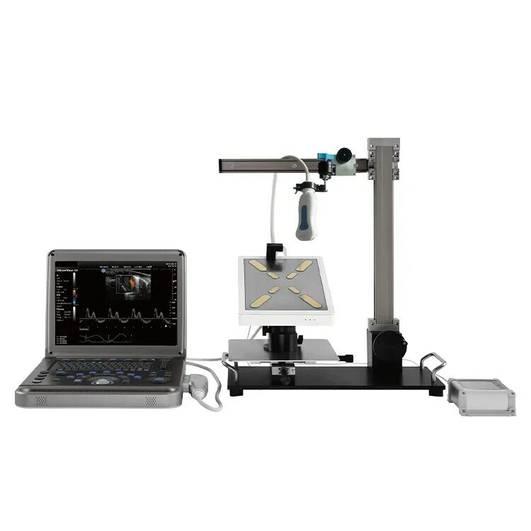 Color Doppler Echo Machine Doppler Ultrasound Ultrasound Machine System With High Quality Ultrasound Machine