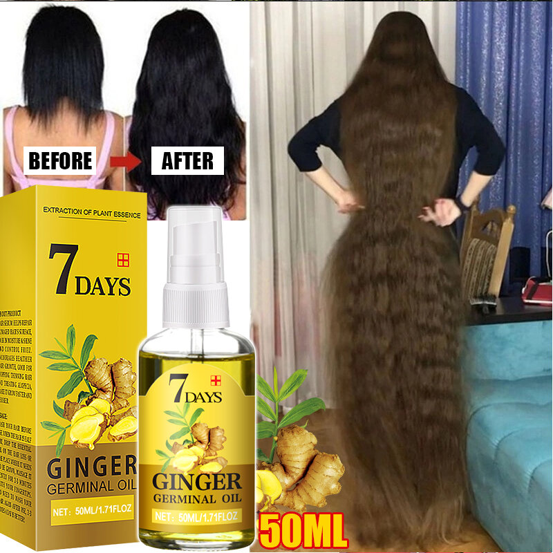 Minyak penumbuh rambut cepat Pria Wanita, produk Serum perawatan kecantikan kesehatan rambut rontok Anti minyak rambut