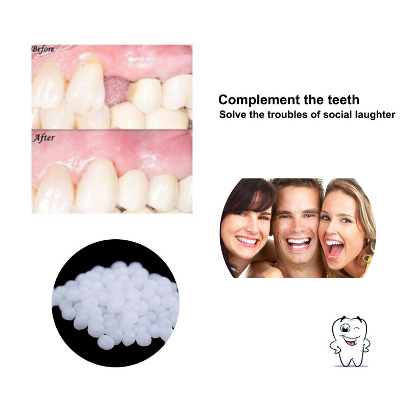 Quente 5g/10g/15g kit de reparação temporária dente dentes e lacunas falseteeth sólido cola dentadura dentes adesivos branqueamento dente ferramentas