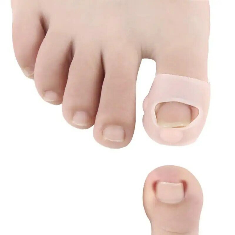 Outil de redressement des ongles incarnés, kit de réparation, soins des ongles, orthèse pour les pieds
