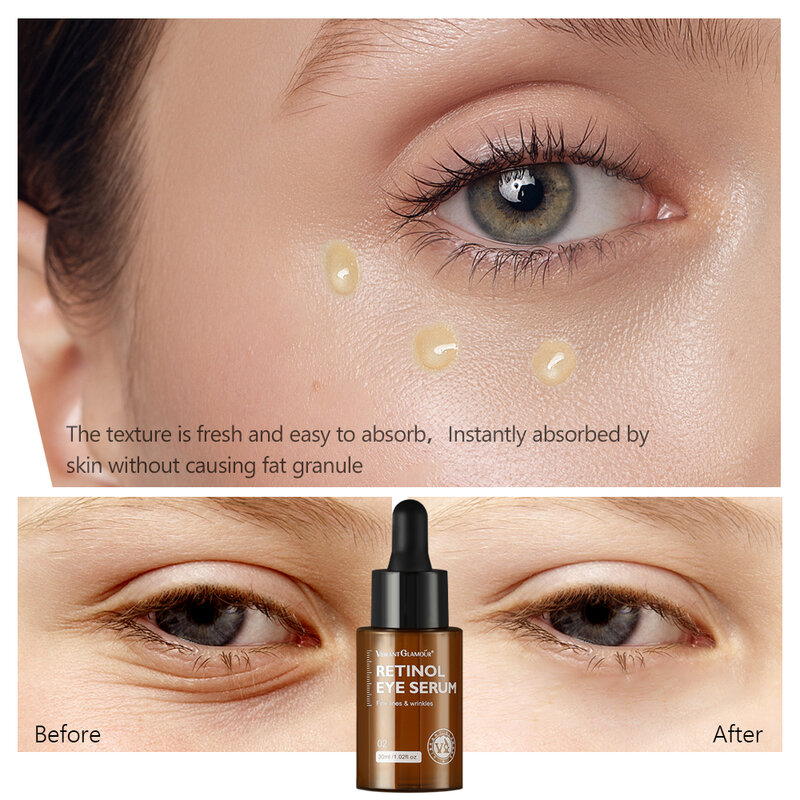 Entfernen Sie Augenringe Retinol Augen serum verbessern Augen taschen heben straffende Essenz verblassen feine Linien feuchtigkeit spendend aufhellen Hautpflege