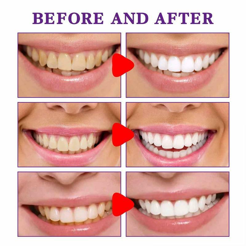 30ml Farb korrektor Zahnpasta Bleaching Zähne Zahnpasta Mun drein igung Pflege Aufhellung Emaille Reparatur mit frischem Atem