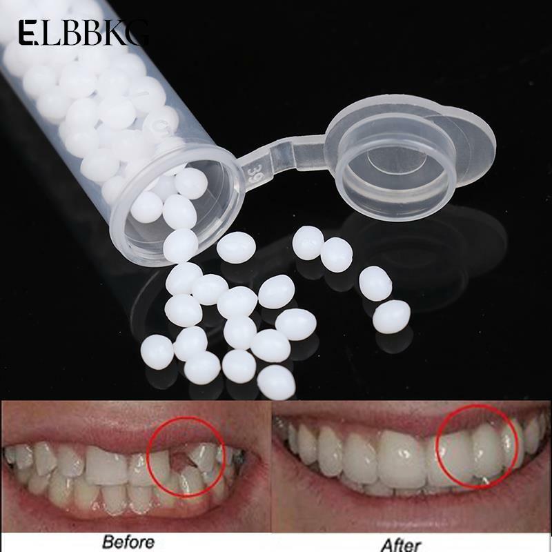 Kit de reparação de dentes temporários e lacunas dentes falsos sólido cola dentadura dentes esparadrapos clareamento do dente ferramenta de beleza
