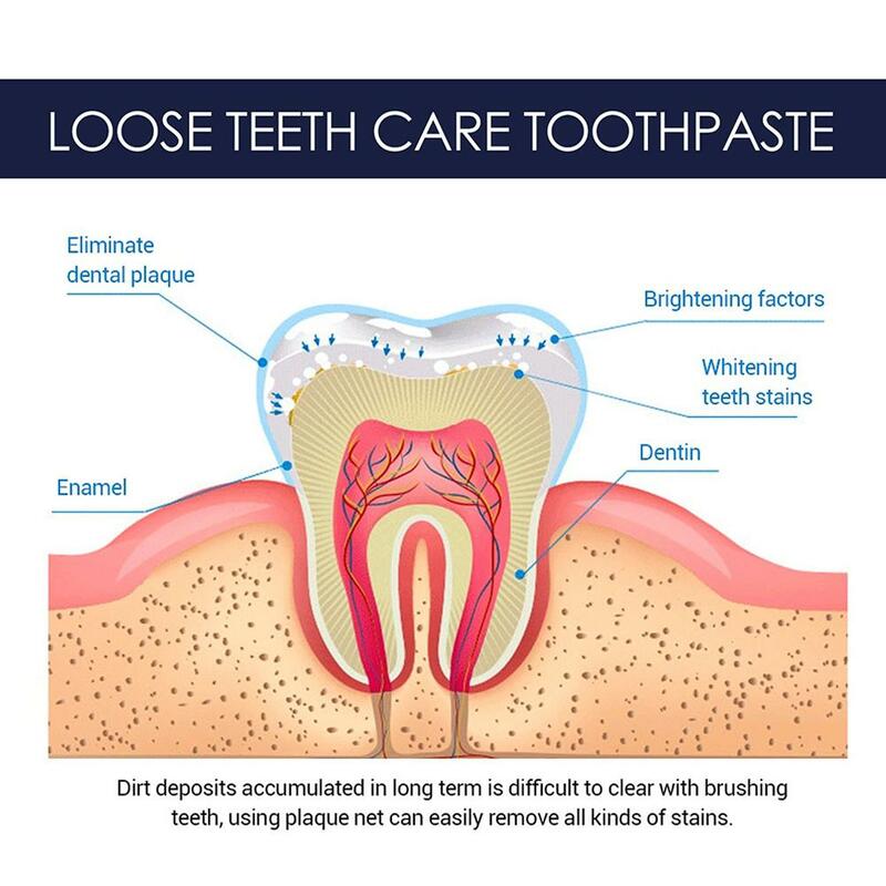 Pasta gigi pemutih kerusakan gigi 120g, pasta gigi pemutih ke noda gigi buruk bertindak cepat untuk napas kuning menghilangkan pemutih mulut segar B6Z3