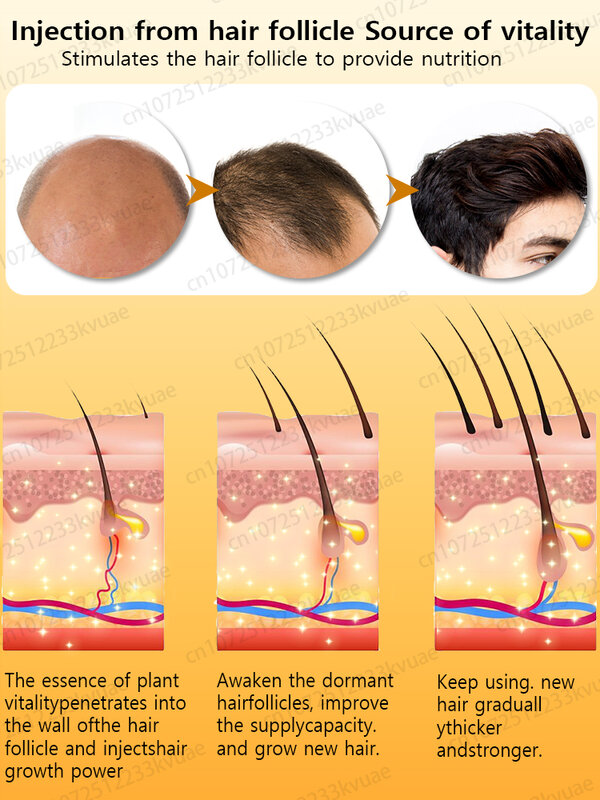 Sólo se necesitan 7 días para reparar la calvicie. El aceite esencial para el crecimiento del cabello puede reparar eficazmente la calvicie.