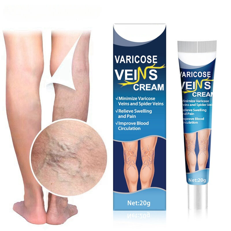 20G varicose vein cream for vasculitis,phlebitis,spider ointment for varicose veins,and medical ointment for removing vasculitis