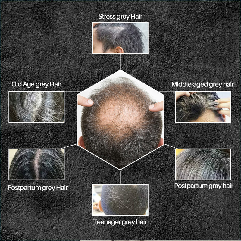 Shampoo para escurecimento do cabelo para homens, sabonete para cobertura de cabelos grisalhos Polygonum Multiflorum, reparo rápido e eficaz, corante branco, 50g