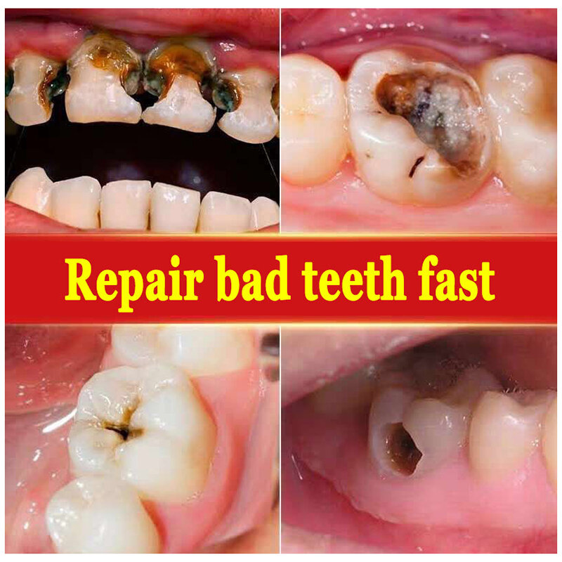 معجون أسنان بروبيوتيك تسوس ، SP 4 ، تبييض ، تسوس الأسنان ، معجون إصلاح ، منظف الأسنان ، مزيل البلاك ، التنفس النقي ، العناية بالأسنان ، 120 جرام