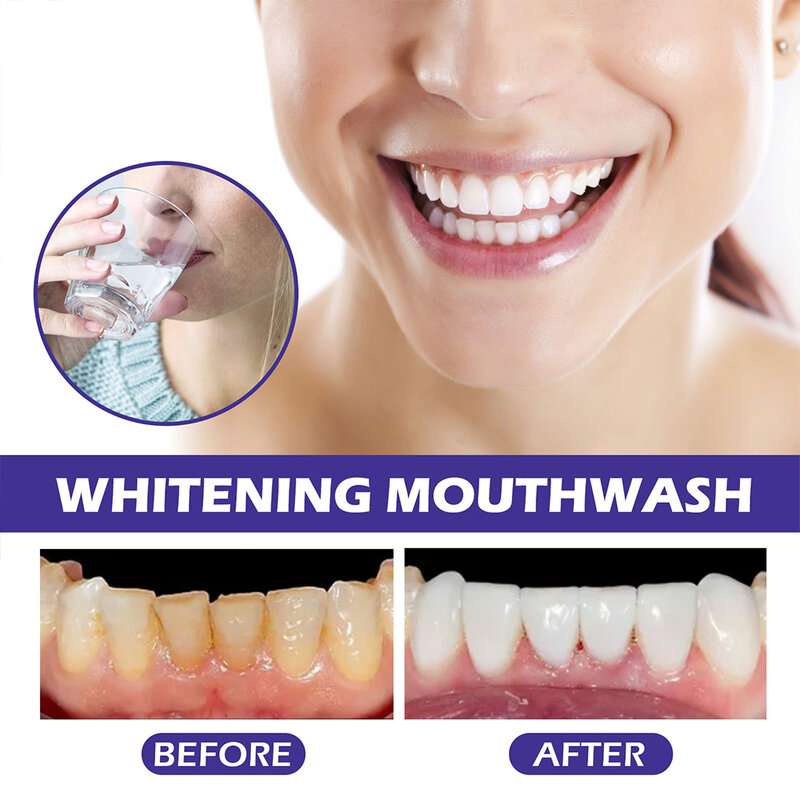 6 Pieces Deep Whitening Mouthwash Home Adults Odor Remover Mouthwashes