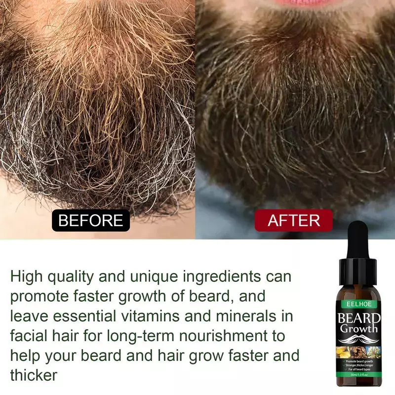 맨유 30ml Man Beard Growth Oil Anti-hair Loss Beard Chest Hair Growth Tool Essential Oil Professional Nourishing Beard Care