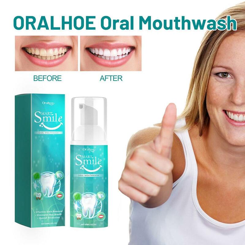 Очищающий зубной мусс для удаления пятен от зубного налета, зубная паста для дыхания, Освежающая зубная пена, кариес, отбеливание полости рта, ремонт, гигиена, поглощение зубов A9B7