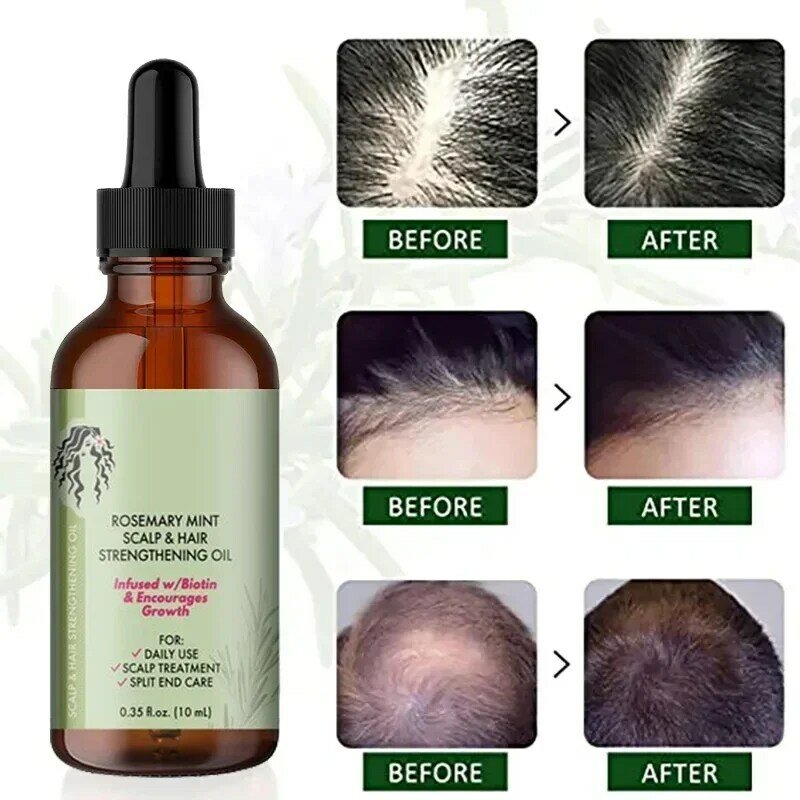 Óleo essencial para o crescimento do cabelo, hortelã natural puro alecrim, tratamento nutritivo para pontas duplas e cabelos secos