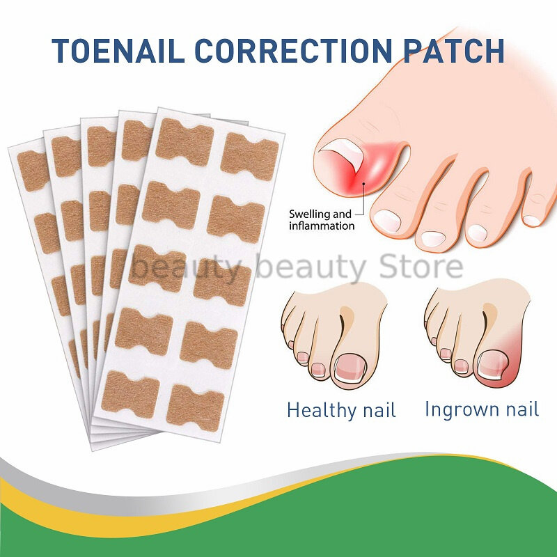 50pcs Ingrown Toenail Correction Tool Nail Correction Stickers Nail Treatment Paronychia Elastic Patch Brace Pedicure Tool
