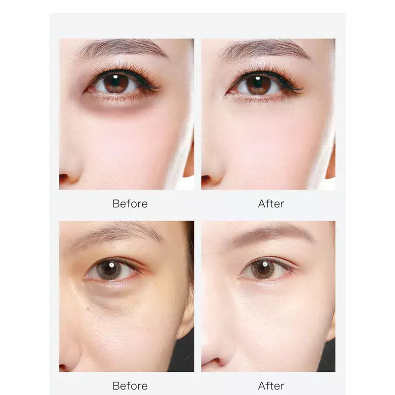 Masque pour les yeux hydratant à l'acide hyaluronique, rafraîchissant, soins pour la peau, améliore les ridules et la matité