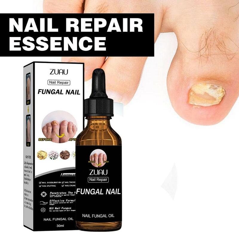 Nail Fungals Renewal Nail Repair Liquid for Discolored Thickened Crumbled Nails Nail Fungals for Discolored Broken Cracked