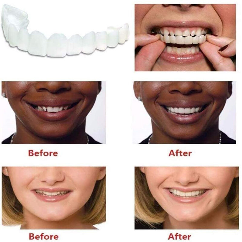 2 pz/set denti superiori denti inferiori sbiancamento dei denti in Silicone copertura dei denti bretelle dei denti simulazione protesi con scatola sorriso perfetto nuovo