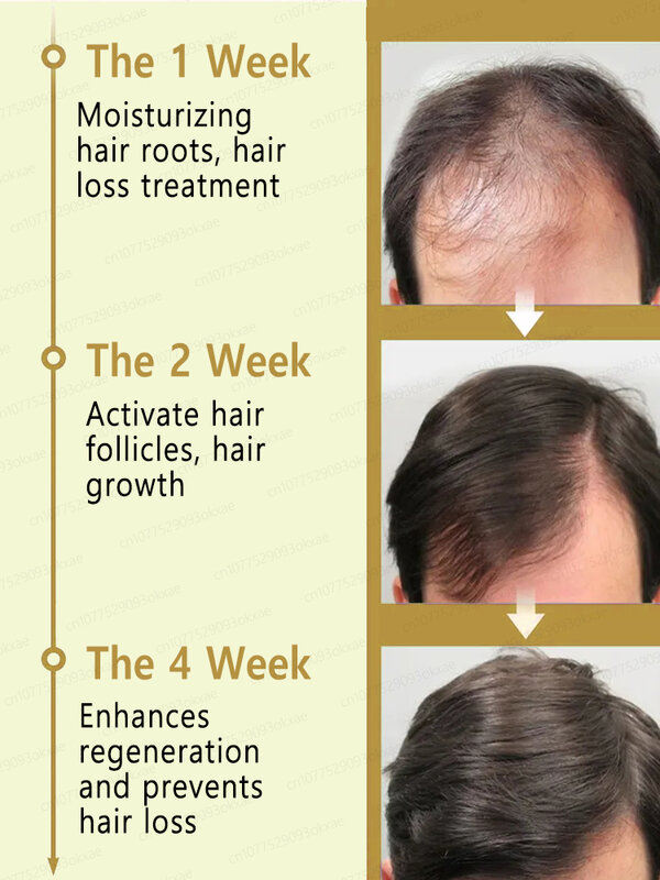 抗alopeciaエッセンシャルオイル,髪の成長,セラム