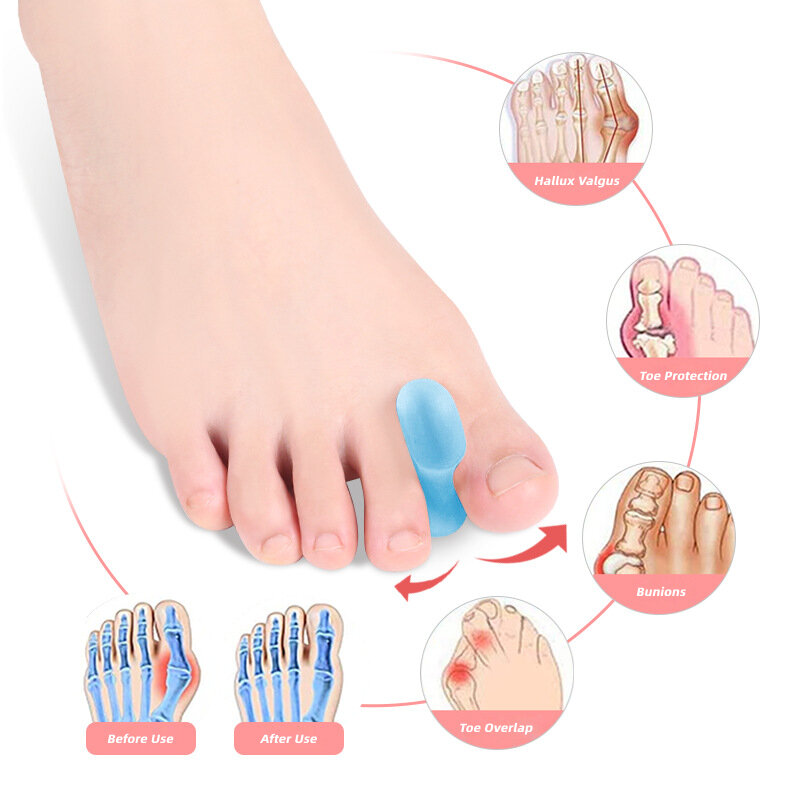 6 buah = 3 pasang pemisah jari kaki Gel pemisah jari korektor pelurus silikon lembut pelindung Spacer alat perawatan kaki pedikur