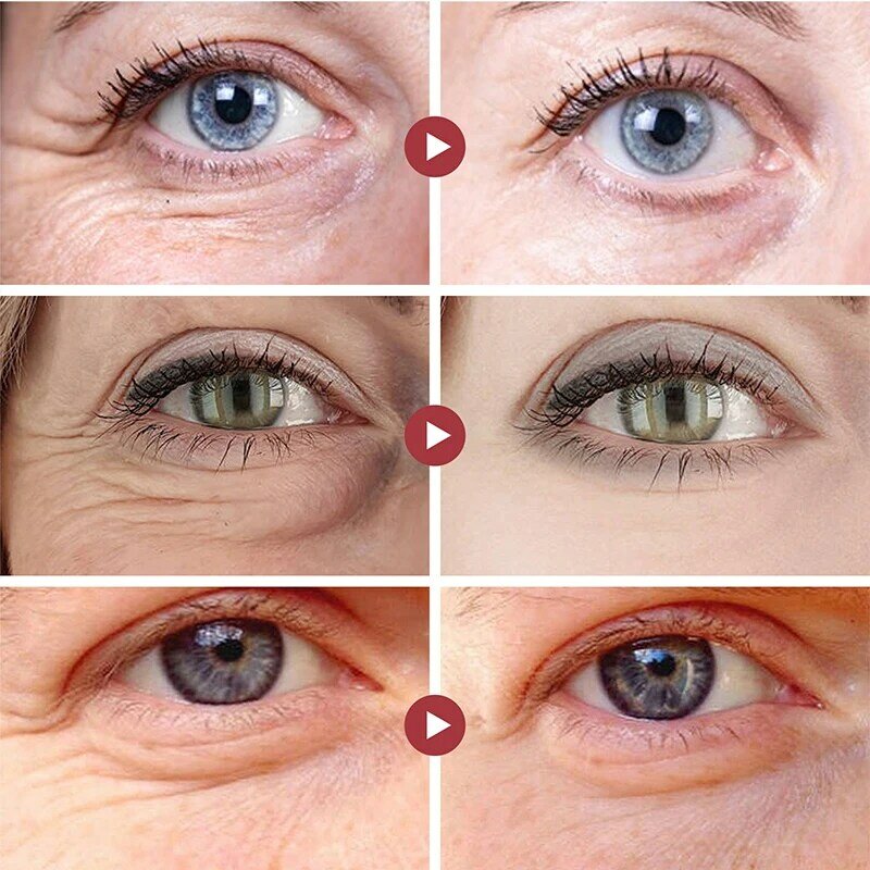 مضاد للتجاعيد كريم العين ريتينول إزالة أكياس العين الهالات السوداء مكافحة الشيخوخة رفع ثبات تبييض ترطيب سطع العناية بالبشرة