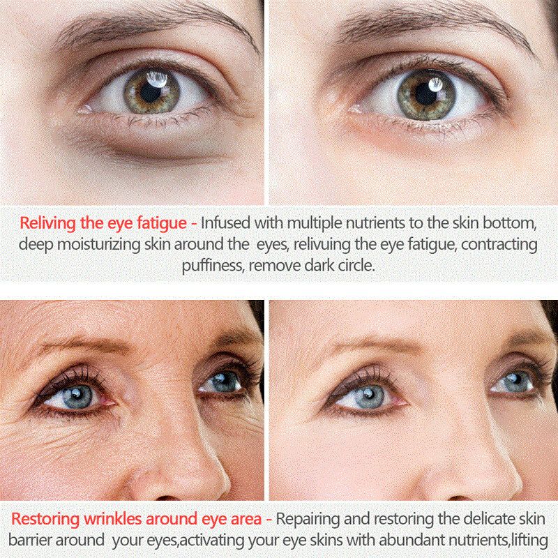 Krim mata Anti Penuaan, 1 buah Anti penuaan keriput mata kolagen peptida menghilangkan lingkaran hitam bengkak terhadap penuaan intens perawatan hidrasi mata