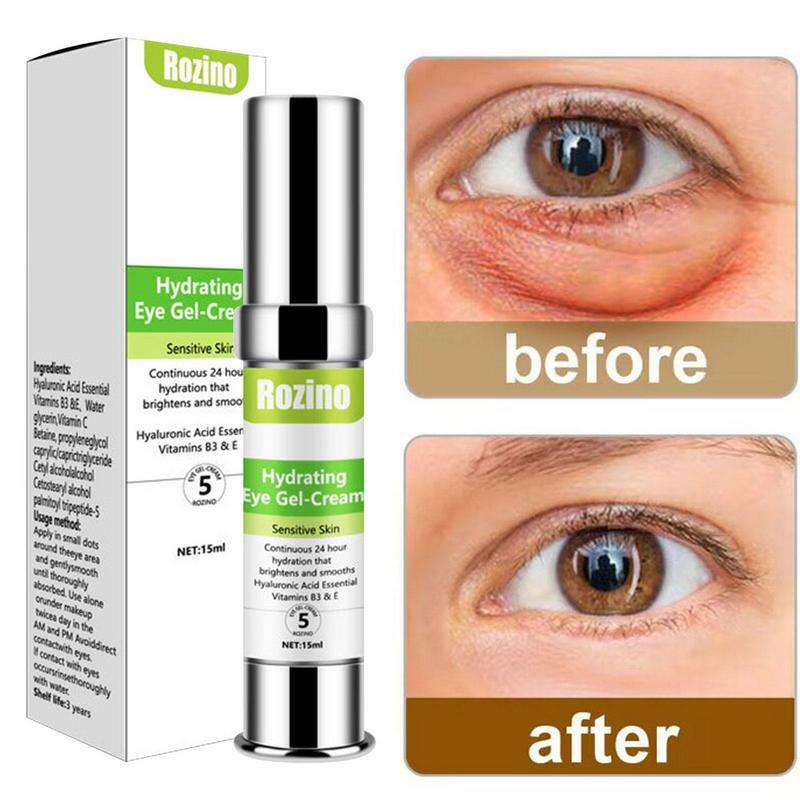 Eye Bags Eye Cream Multi-effects Wrinkle Removal Anti Aging Tightening Puffiness Under Eye Skin Care Beauty