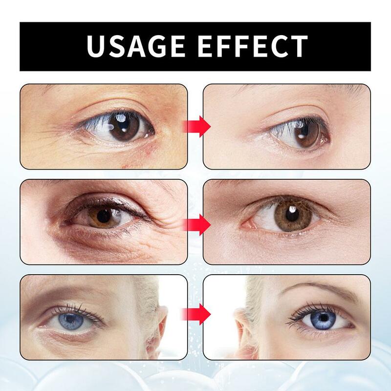 Pielęgnacja oczu zmarszczek tymczasowe usuwanie worki pod oczami kremów pod oczy krem pod oczy ujędrniający skórę pod oczami podnoszenie ciemne koła usuwania worka ujędrniający skórę pod oczami