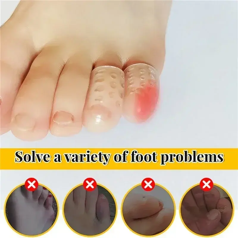 30 pezzi tappi per dita in Silicone trasparente Anti-attrito protezione per dita traspirante previene le vesciche tappi per le dita protezioni per la copertura cura dei piedi