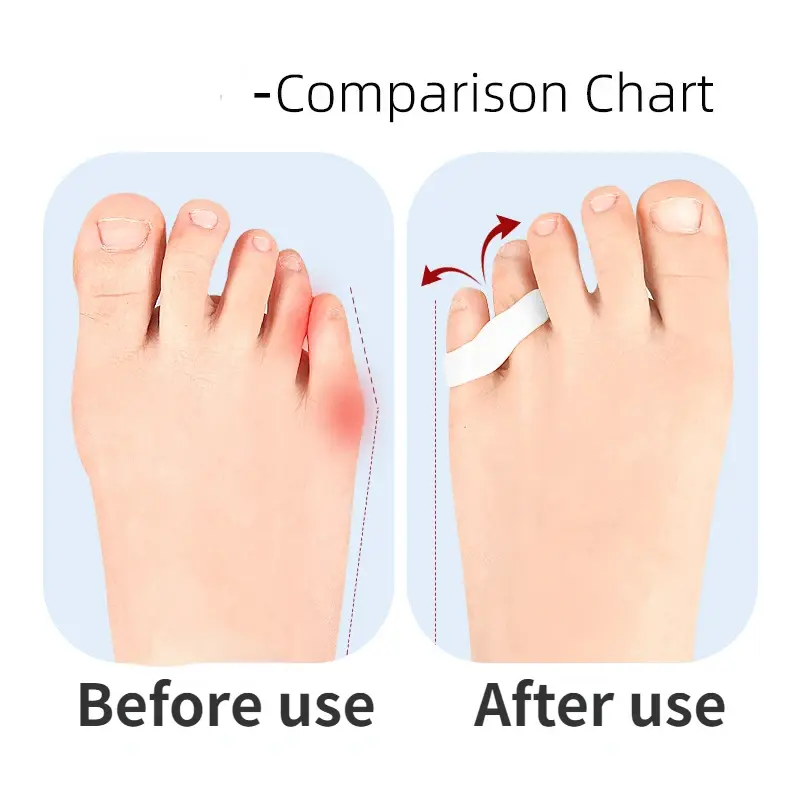 Разделительный сепаратор для маленьких пальцев ног, нейтральное устройство для разделения костей ног, корректор для маленьких пальцев ног