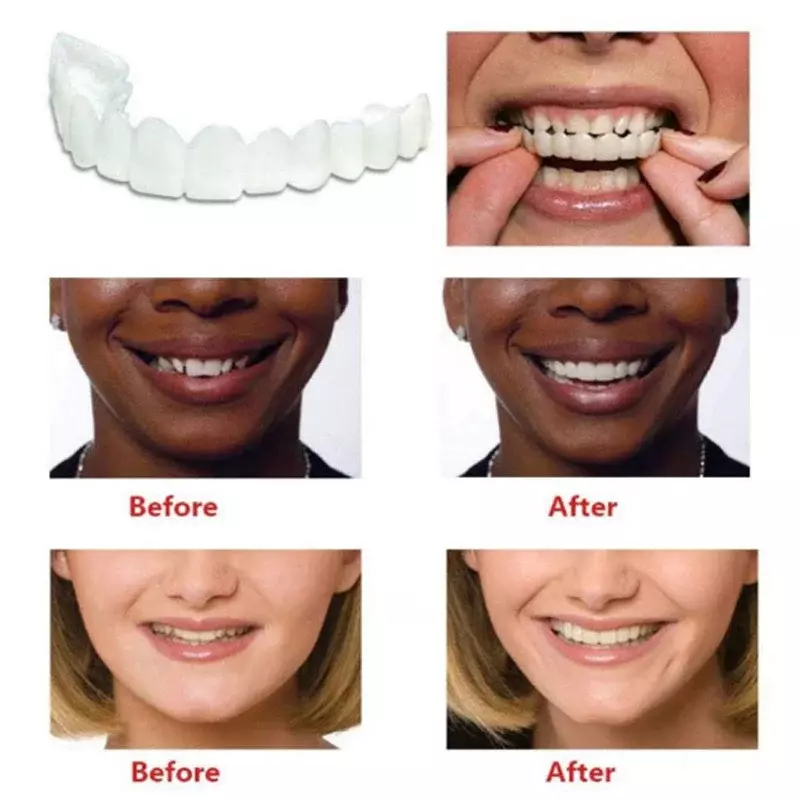Penutup gigi palsu sempurna untuk pemutih gigi, jepret silikon senyum, gigi tiruan fleksibel, alat kecantikan kosmetik
