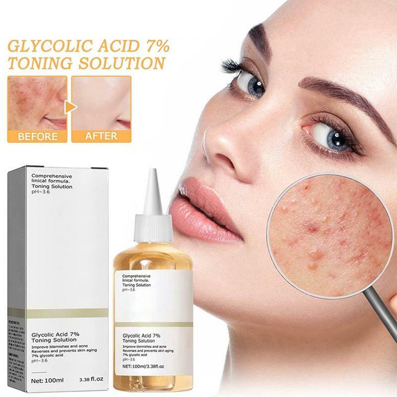 Acide glycolique 7% tonifiant, élimine l'acné, estompe les marques d'acné, améliore l'hydratation de la peau, blanchit, hydrate, tonifie, produit original
