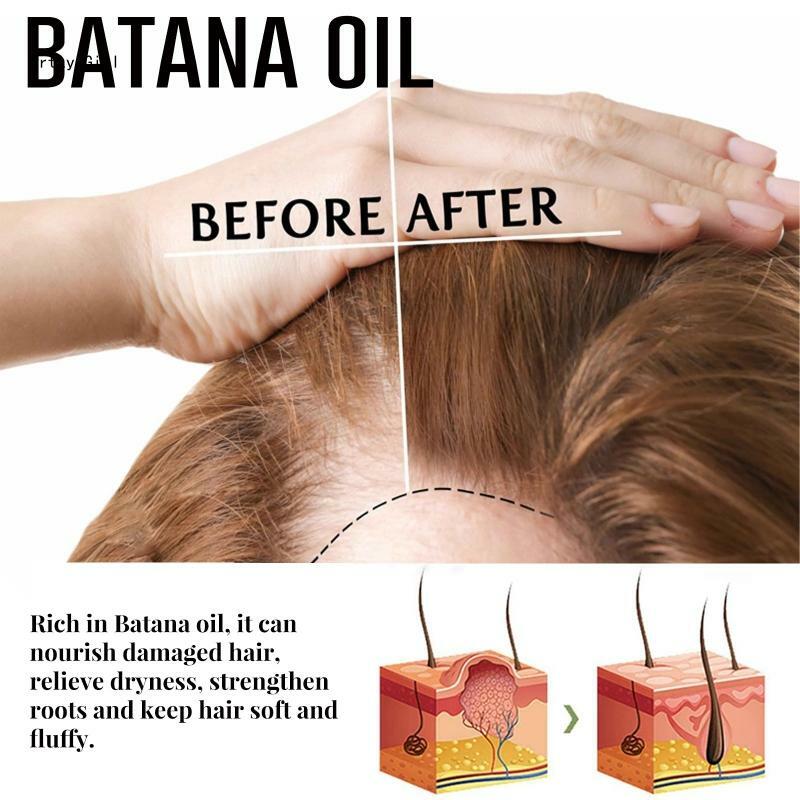 Shampoo anti-queda barra Batana Oil Sabonete capilar adequado para todos os tipos cabelo D2TA