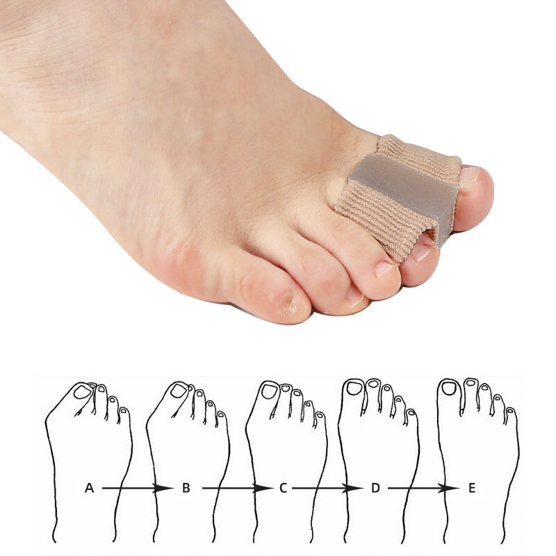 2 stücke Silikon Zehen streuer Separator Bunion Hallux Valgus Korrektor Daumen Finger Korrektur Glätte isen Fußpflege-Tool