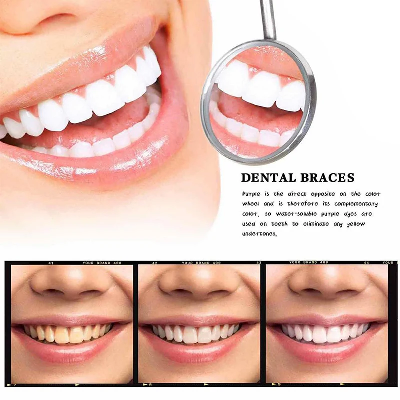 ชุดยิ้มยาสีฟันสีม่วง V34คอลเลอร์แก้ไขฟันสำหรับฟอกสีฟันสดใสลดสีเหลืองทำความสะอาดฟันดูแลฟัน30มล.