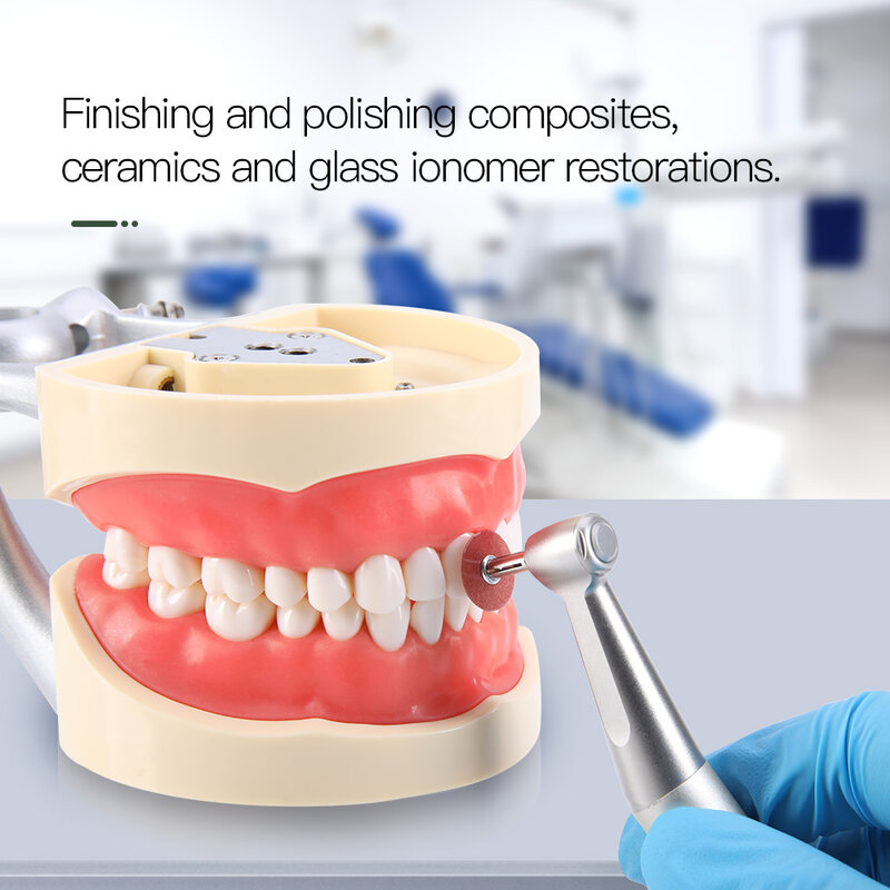 Discos de acabamento e polimento dentário para restaurações de ionômeros de vidro, superfino, fino, médio e grosso