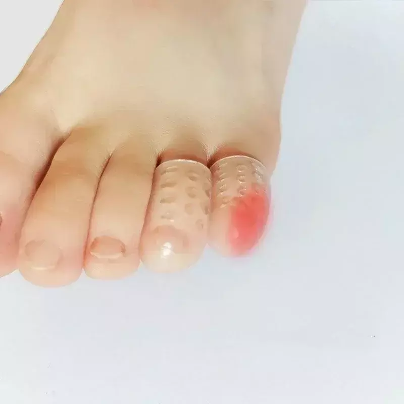 Transparente Silicone Toe Covers para Mulheres, Little Toes, Tubo Protetor, Cuidados com os Pés, Finger Caps, Elasticidade, Evita Blisters, Gel, 5-30Pcs