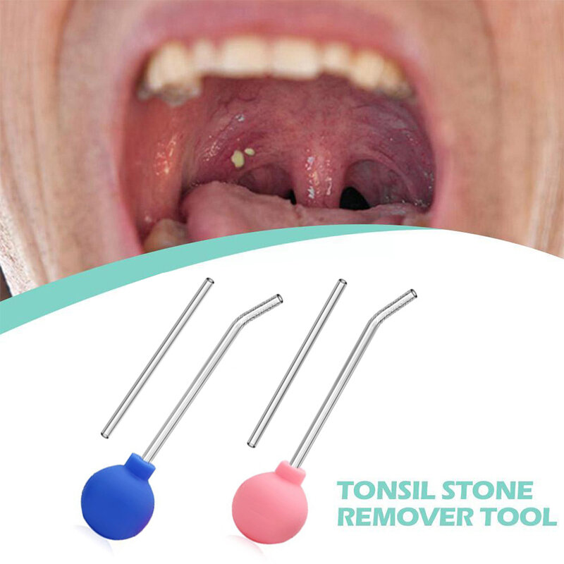 Tonsil อุปกรณ์กำจัดหินปากแบบแมนนวลเครื่องมือทำความสะอาดปากดูแลหูขี้ผึ้ง tonsil หินดูดบอลทำความสะอาดสไตล์ด้วยตนเอง