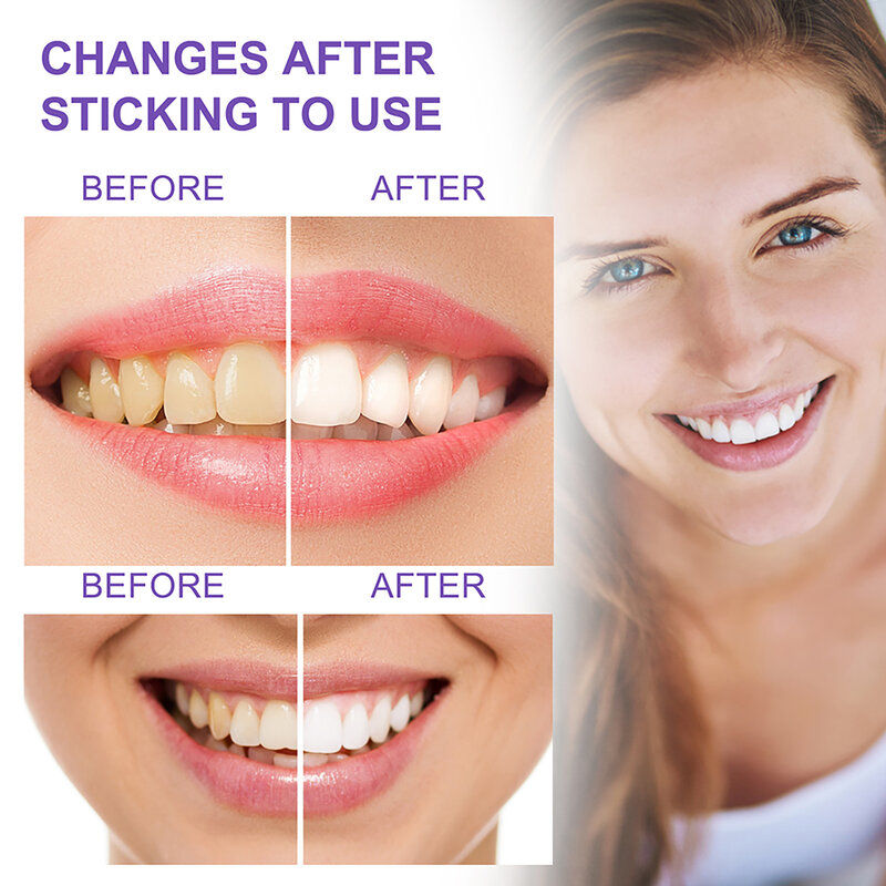 Oral Care Whitening Toothpaste, Fortalecimento do gel de remoção de mancha, Creme dental para uma respiração fresca duradoura