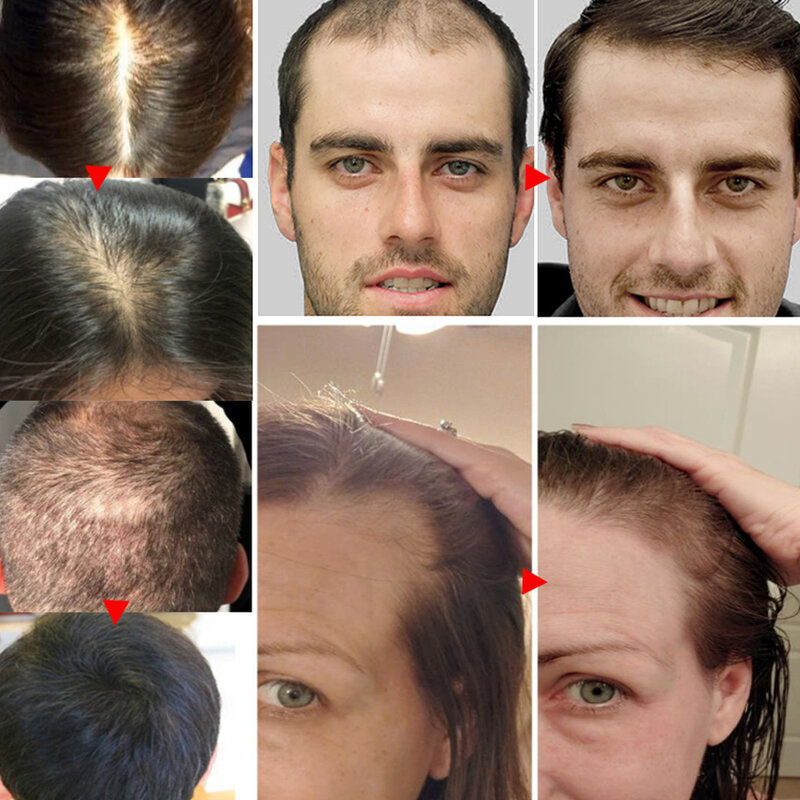 Yiganjing-髪の成長のための流体,天然の美容オイル,中国のセックスと頭皮のケア,新しい,20ml, 5個