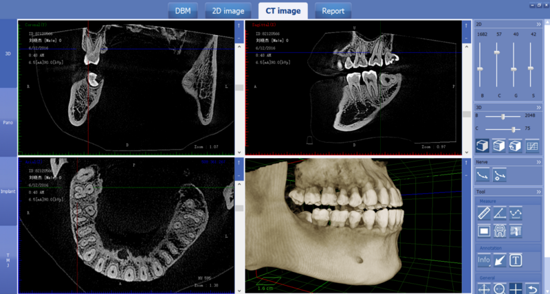 Máquina de raio X dental, Cbt, equipamento, mais novo